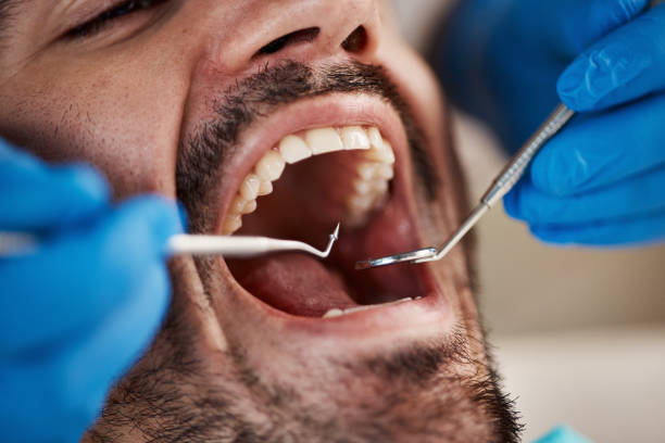 Best Emergency Dentist for Knocked-Out Tooth in Whitewater, CA
