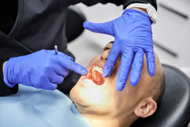 Best Emergency Dental Care for Abscessed Tooth in Whitewater, CA